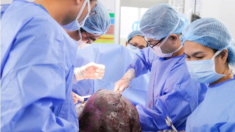 Bóc tách u xơ tử cung 12kg cho bệnh nhân 25 tuổi