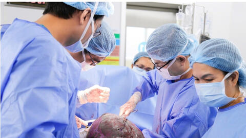 Bóc tách u xơ tử cung 12kg cho bệnh nhân 25 tuổi