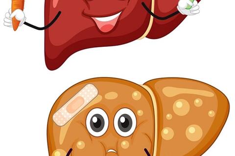Không uống rượu bia vẫn bị gan nhiễm mỡ, ăn gì để ‘gan khỏe’?