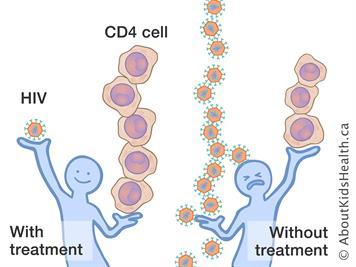 Phát hiện biến thể virus HIV mới, tiến triển thành AIDS nhanh gấp đôi chủng cũ - Ảnh 3.