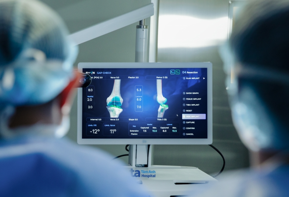 Bệnh viện Tâm Anh ứng dụng Robot thay khớp CUVIS-Joint đầu tiên tại Việt Nam Bệnh viện Tâm Anh ứng dụng Robot thay khớp CUVIS-Joint đầu tiên tại Việt Nam